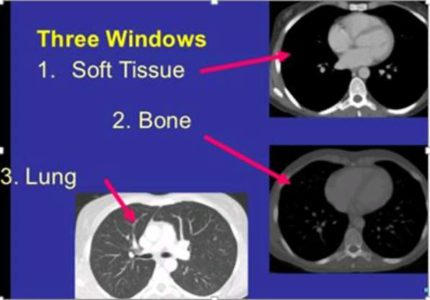 pacs-CTwindow-image