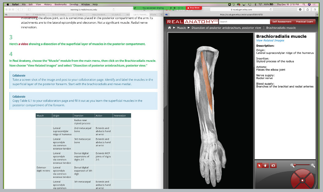 ACS-blog-pandemic-anatomy-image1