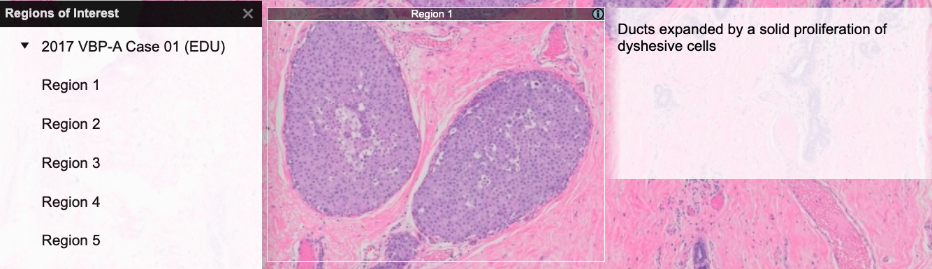 digital-scope-region-interest-image
